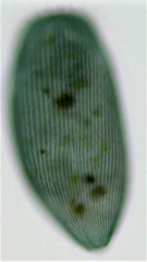 Stentor coeruleus