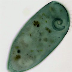 Stentor coeruleus