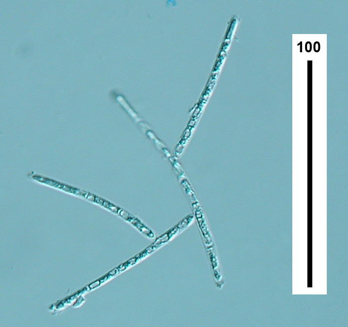 Varicosporium