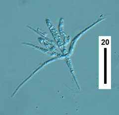 Tetracladium setigerum