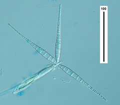 Flabellospora acuminata