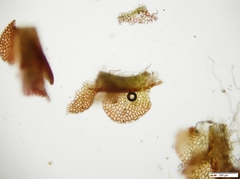 Solenostoma gracillimum