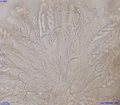 Pezizellaceae