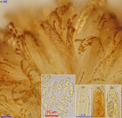 Pezizellaceae