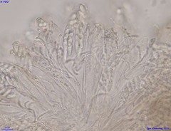 Pezizellaceae