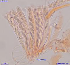 Pezizellaceae