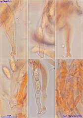Pezizellaceae