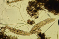 Stenostomum constrictum