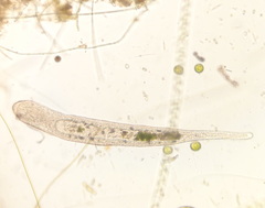 Stenostomum