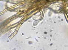 Cyphellopsis anomala image