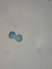 Trichia crateriformis