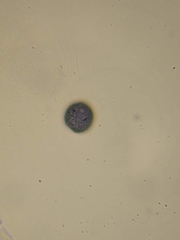 Trichia crateriformis