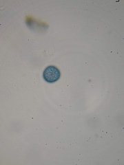 Trichia crateriformis