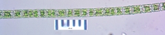 Hyalotheca