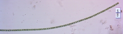 Hyalotheca