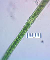 Pleurotaenium