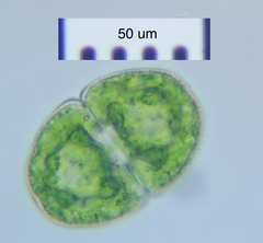 Cosmarium pseudopyramidatum