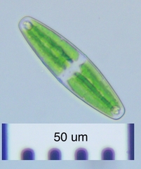 Closterium navicula
