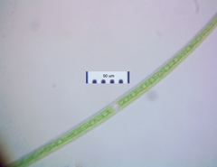 Closterium angustatum