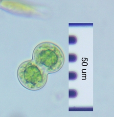 Actinotaenium globosum