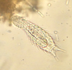 Chaetonotus