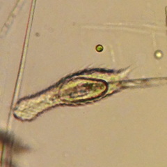 Chaetonotus