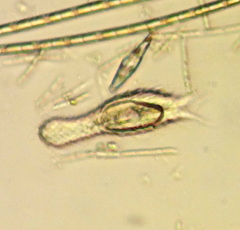 Chaetonotus
