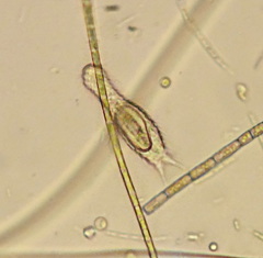 Chaetonotus