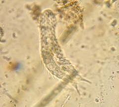 Chaetonotus