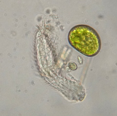 Chaetonotidae