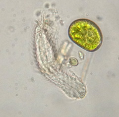 Chaetonotidae