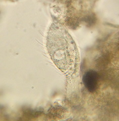 Chaetonotidae