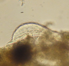 Chaetonotidae