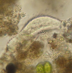 Chaetonotidae