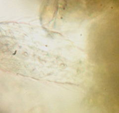 Chaetonotidae