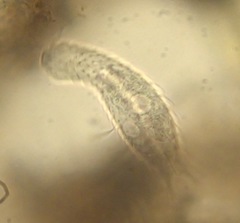 Chaetonotidae