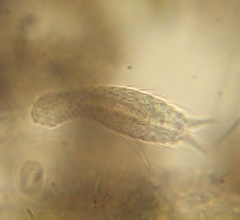 Chaetonotidae