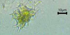 Staurastrum hystrix