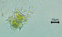 Staurastrum hystrix