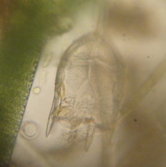 Keratella cochlearis