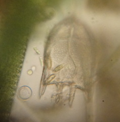 Keratella cochlearis