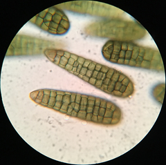 Berkleasmium conglobatum