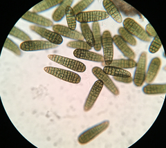 Berkleasmium conglobatum