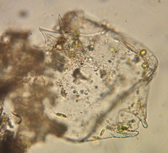 Rotifera