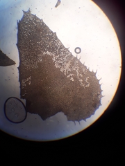 Plagiochila annotina