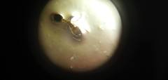 Myrmicinae