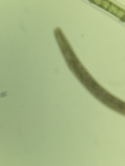 Spirostomum
