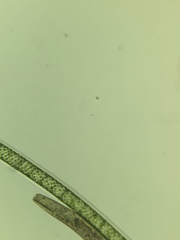 Spirostomum