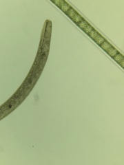 Spirostomum