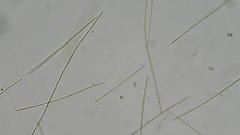 Planktothrix